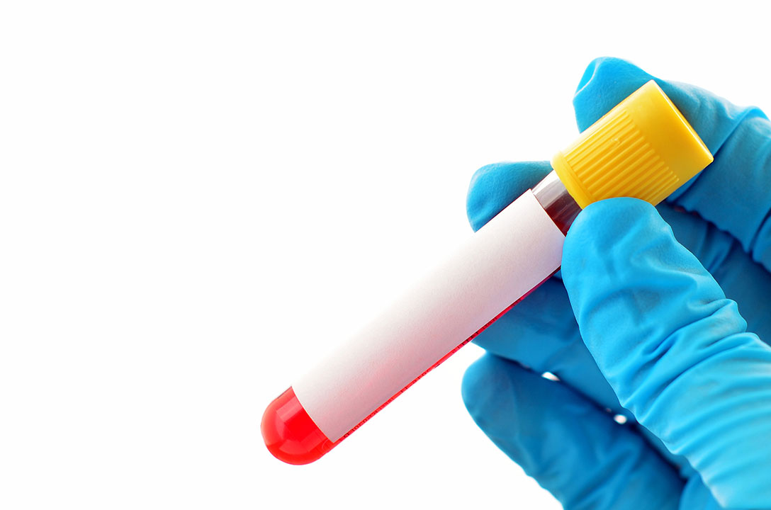 A blue-gloved hand holds a blood sample tube with a yellow cap and blank white label.
