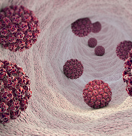 3D render of dark red, textured spherical virus particles inside a pale body cavity.