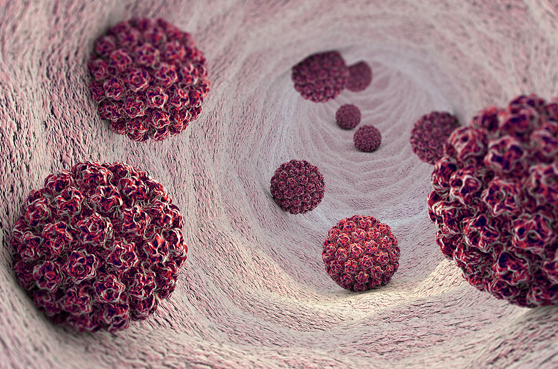 3D render of dark red, textured spherical virus particles inside a pale body cavity.