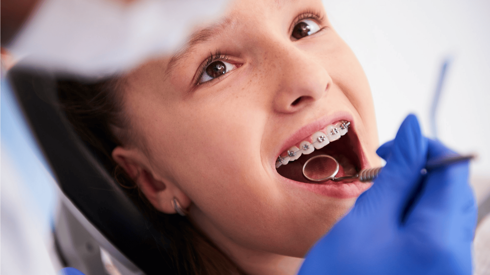 Braces Care Checklist: Do's and Don'ts for Healthy Teeth