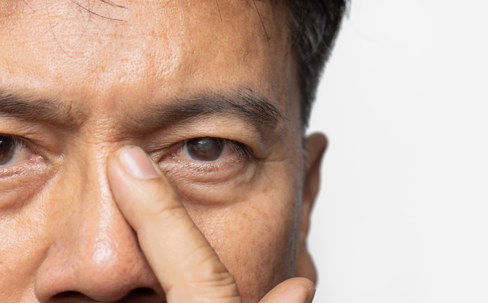 Close-up of a man's eye
