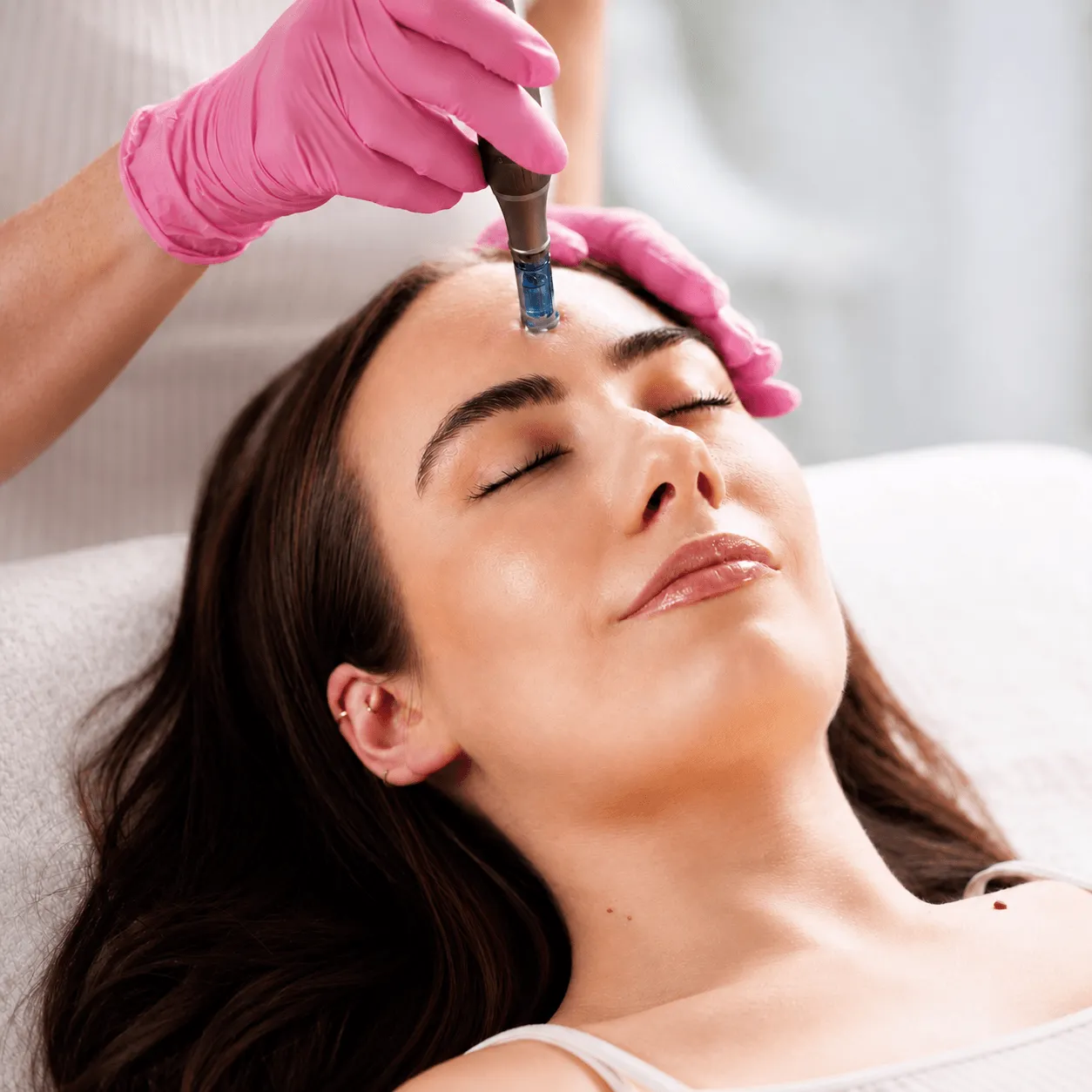 Microneedling treatment at Fountain of Glo med spa in Staten Island, NY