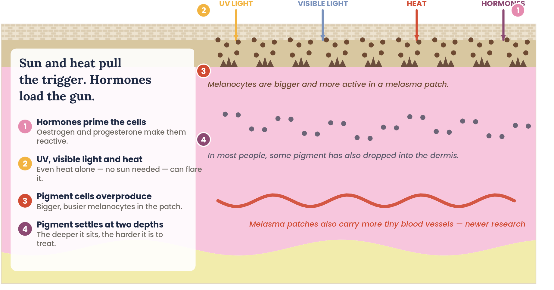 Diagram showing how sun, heat and hormones trigger pigment cells in melasma