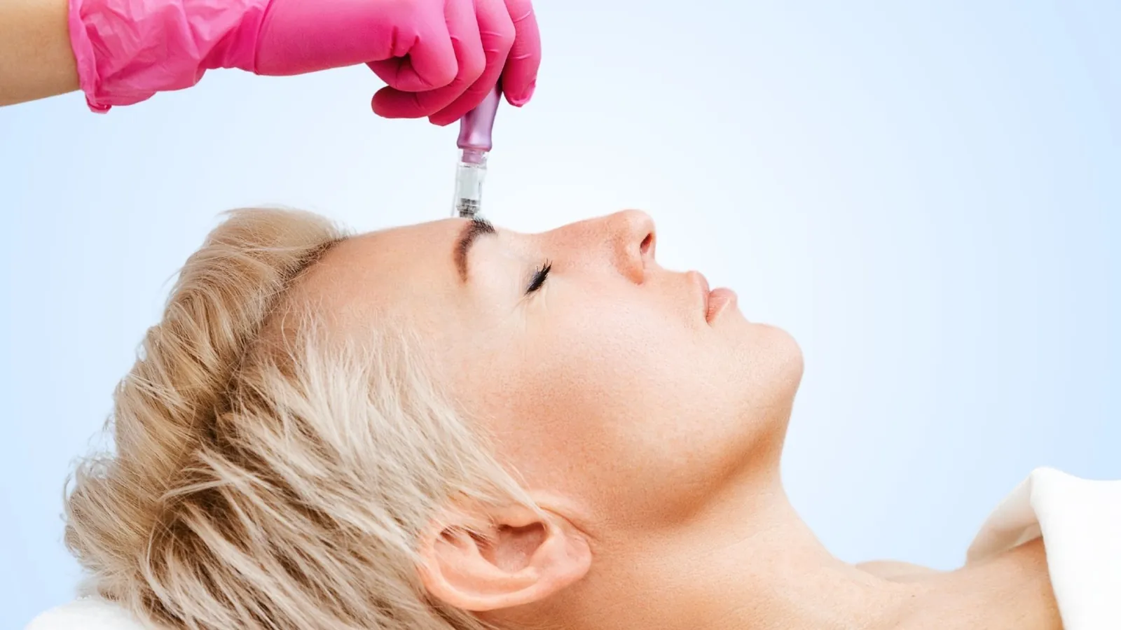 Gloved hand holding a microneedling pen against a person's forehead.