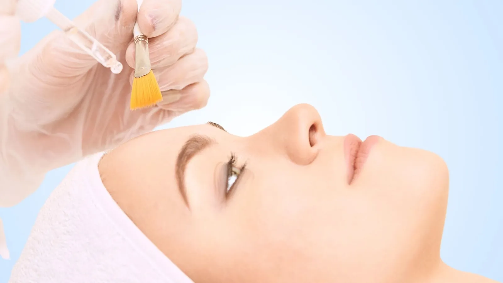 Chemical peels