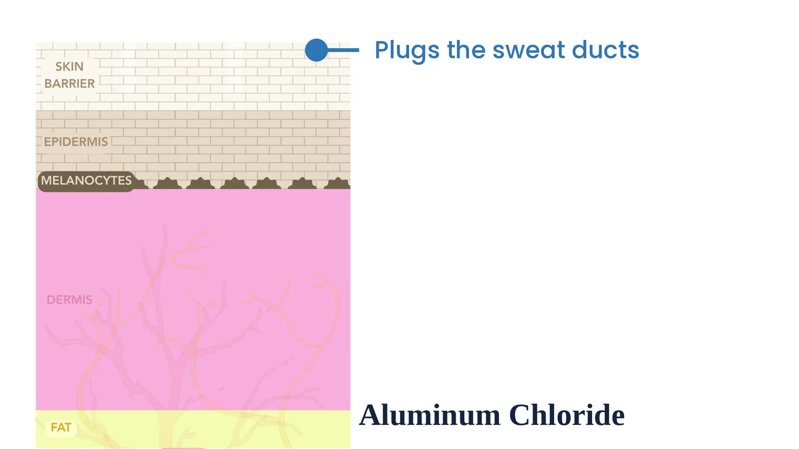 Aluminum chloride