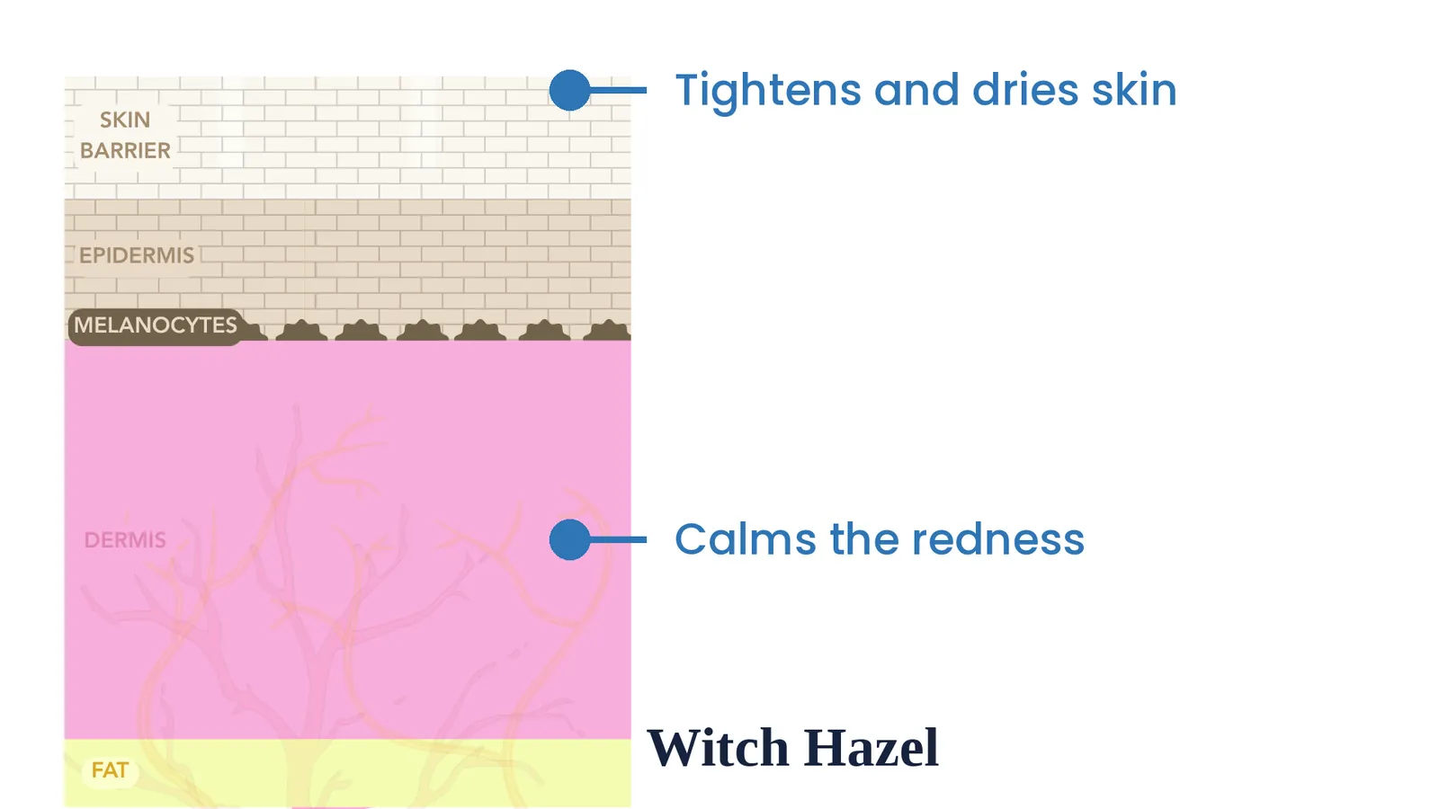 Witch hazel