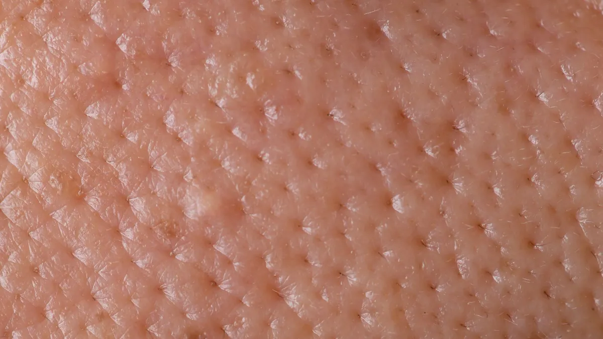 Normal Skin