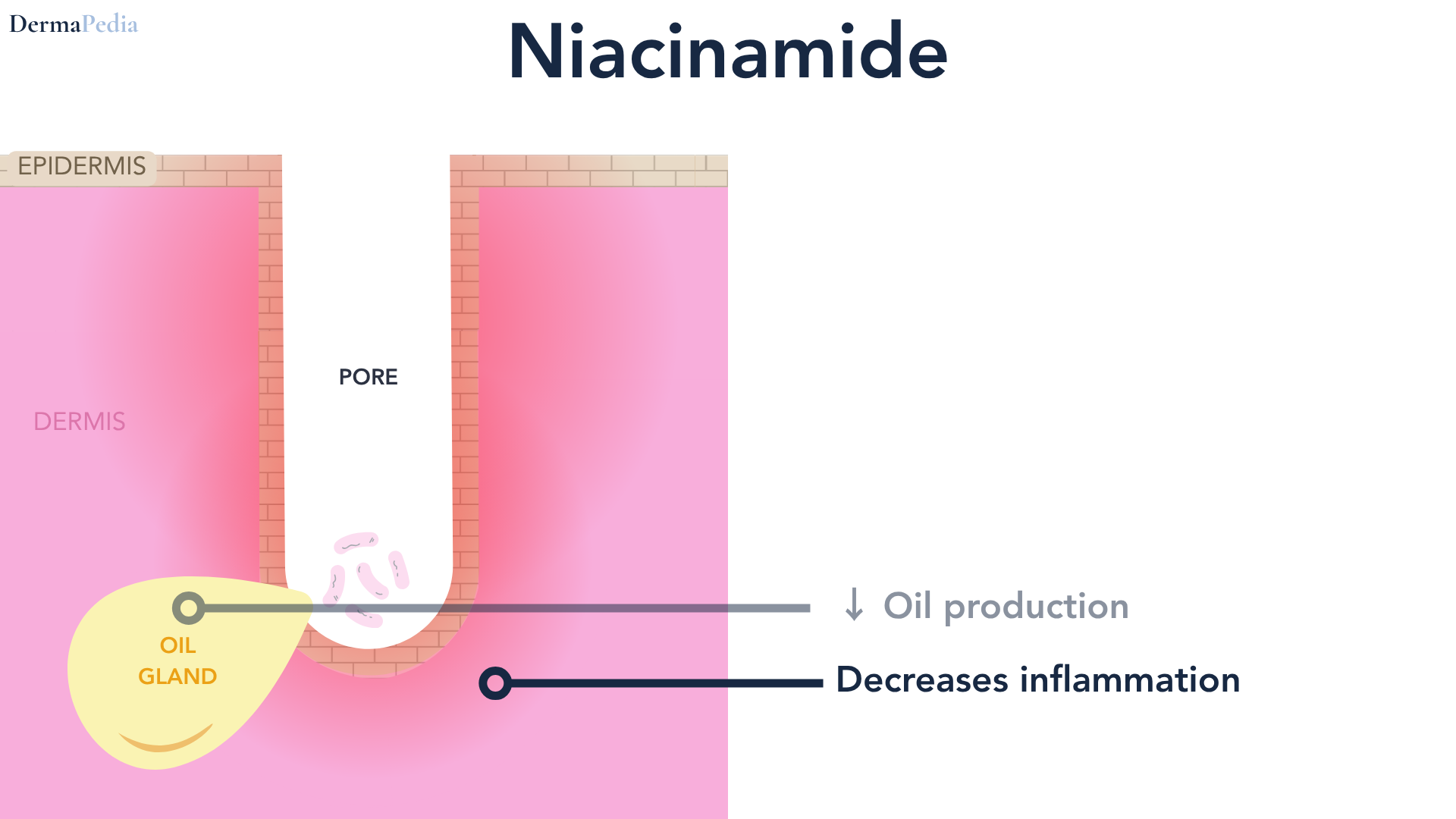 Labeled cutaway diagram of a single skin pore, headed Niacinamide. The epidermis is a brick-textured band across the top and the dermis is pink below it, with a yellow oil gland at the base of the pore and a cluster of bacteria inside it. Two callout lines point in: decreases inflammation is drawn in dark navy as the main effect, and decreases oil production is drawn in gray as a lesser one. Nothing points at the dead cells blocking the pore.