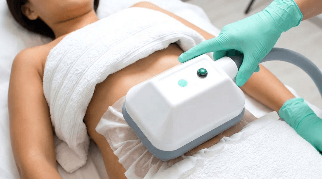 CoolSculpting A gloved hand holding a large white cooling applicator against a woman's abdomen as she lies on a treatment bed