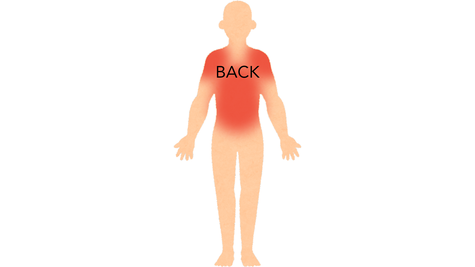 Back view of a whole body with red marks across both shoulders and down the upper and middle back. The rest of the body is clear.