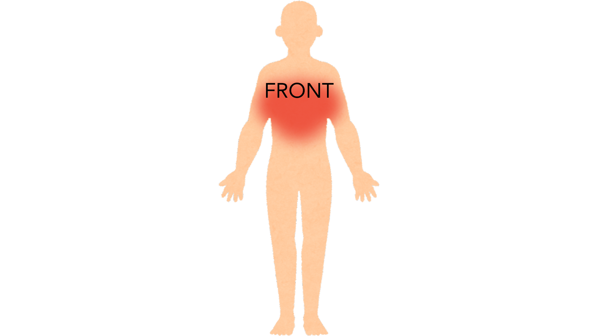 Front view of a whole body with red marks across the upper chest. The rest of the body is clear.