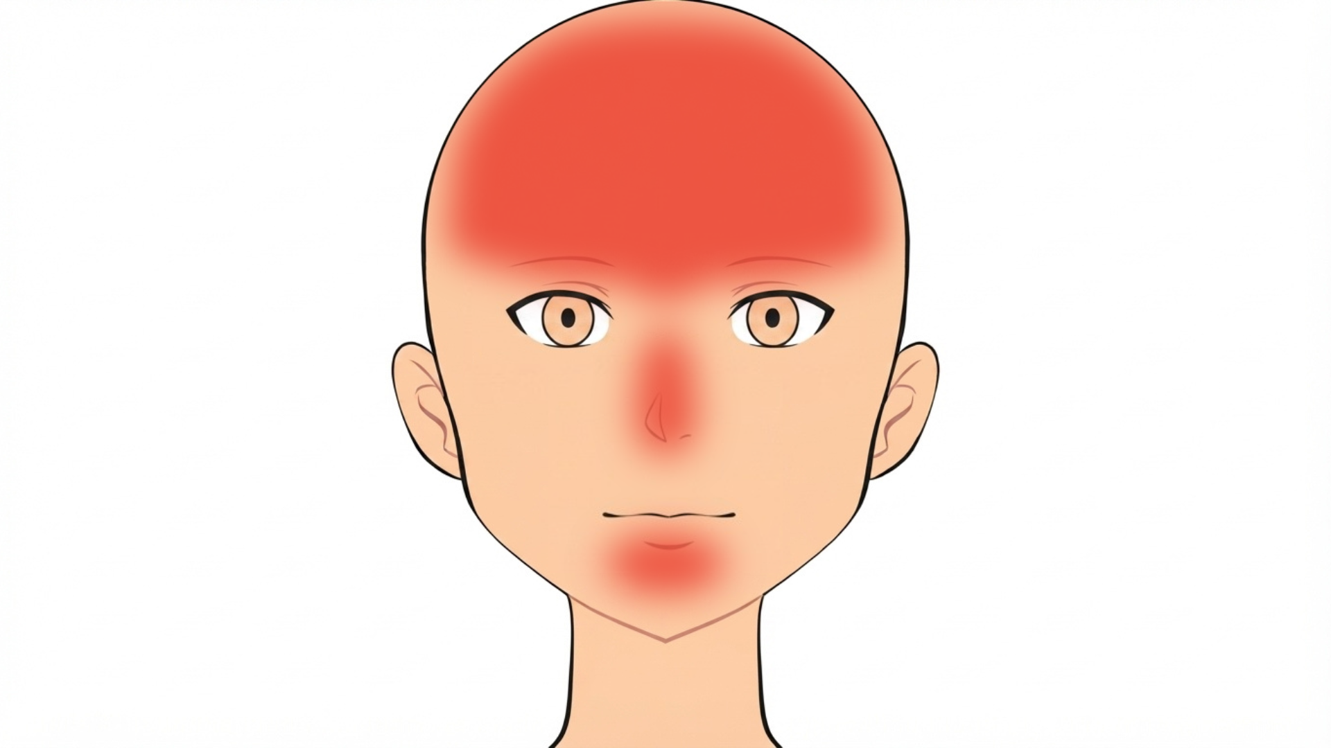 Front view of a head with red marks across the hairline and forehead, between the brows, on the nose and on the chin. The sides of the face are clear.