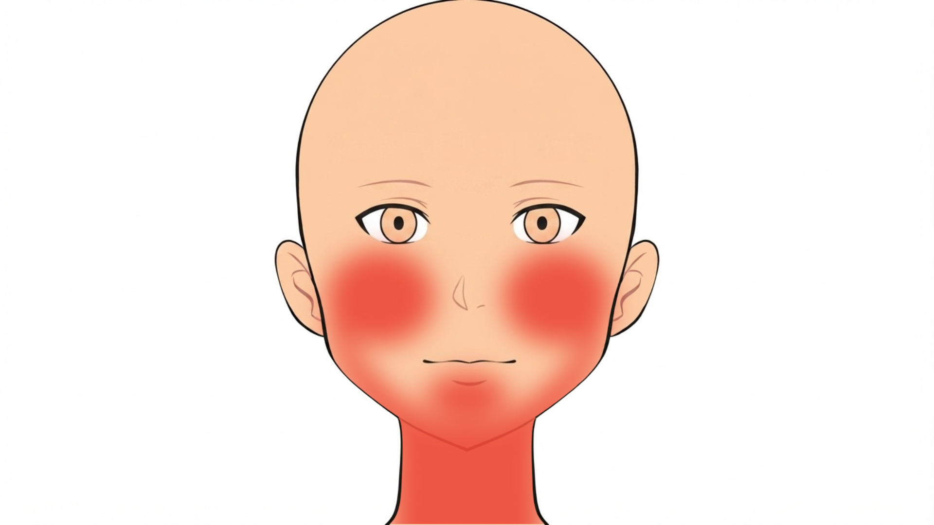 Front view of a head with red marks along both sides of the jaw, on the chin, on both lower cheeks and on the front of the neck. The forehead is clear.