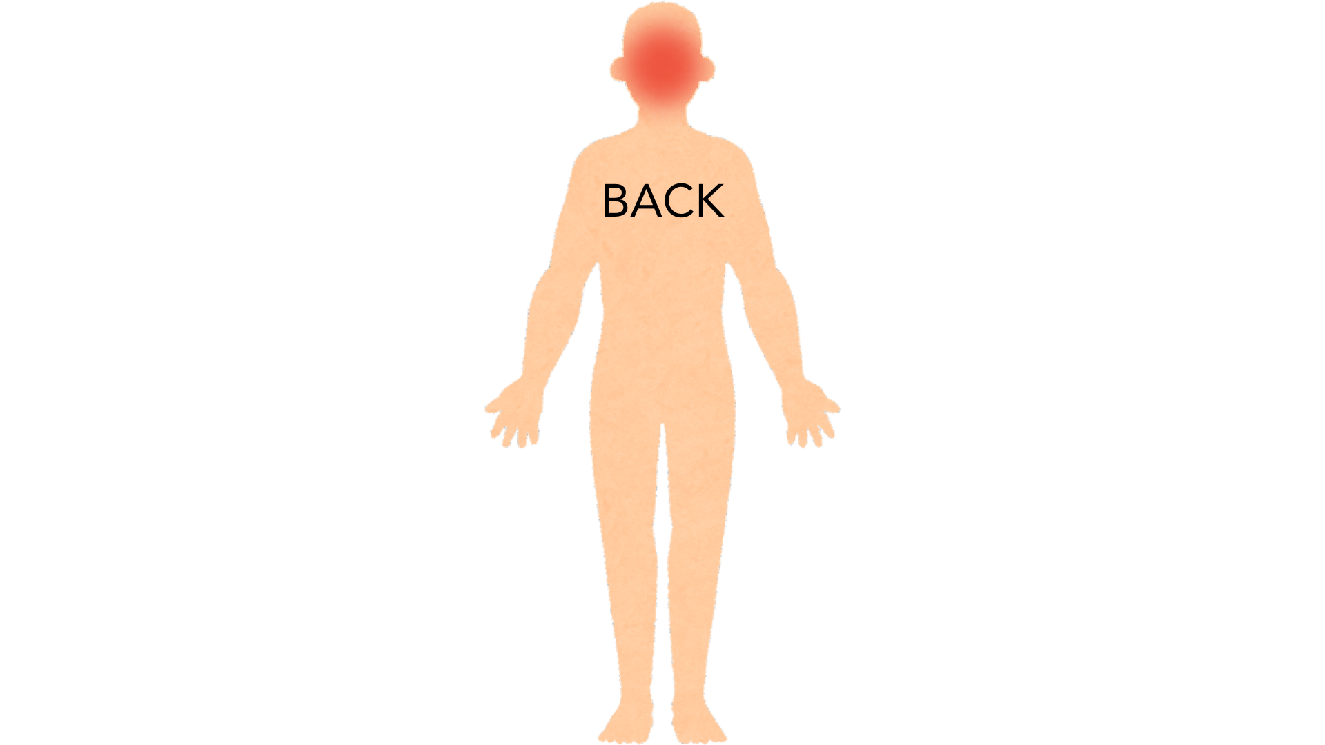 Back view of a whole body with a red mark on the crown at the back of the head. The rest of the body is clear.