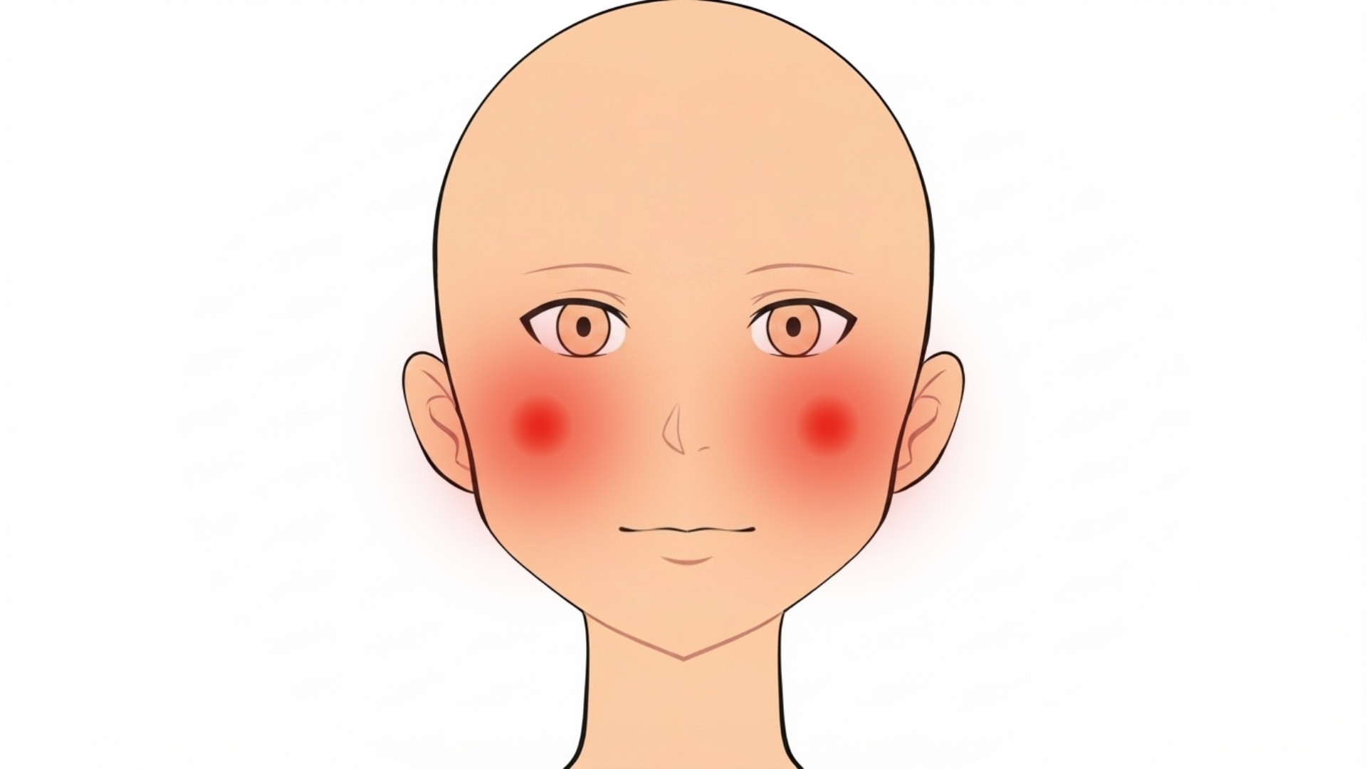 Front view of a face with soft brown patches over both cheekbones, reaching out toward both temples. The forehead and lips are clear.