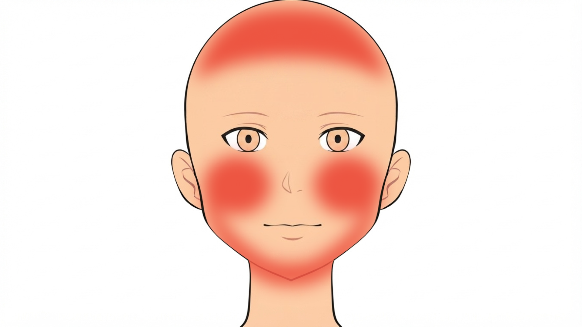 Front view of a head with red marks across the scalp, on both cheeks and along the beard area of the jaw.