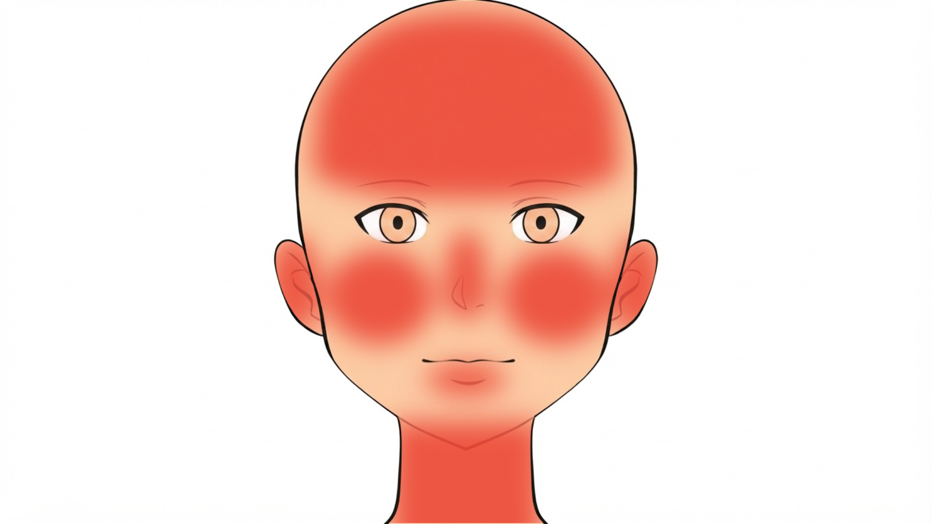 Front view of a head with red marks across the scalp and forehead, on both ears, on the nose, on both cheeks, on the lower lip and on the neck.