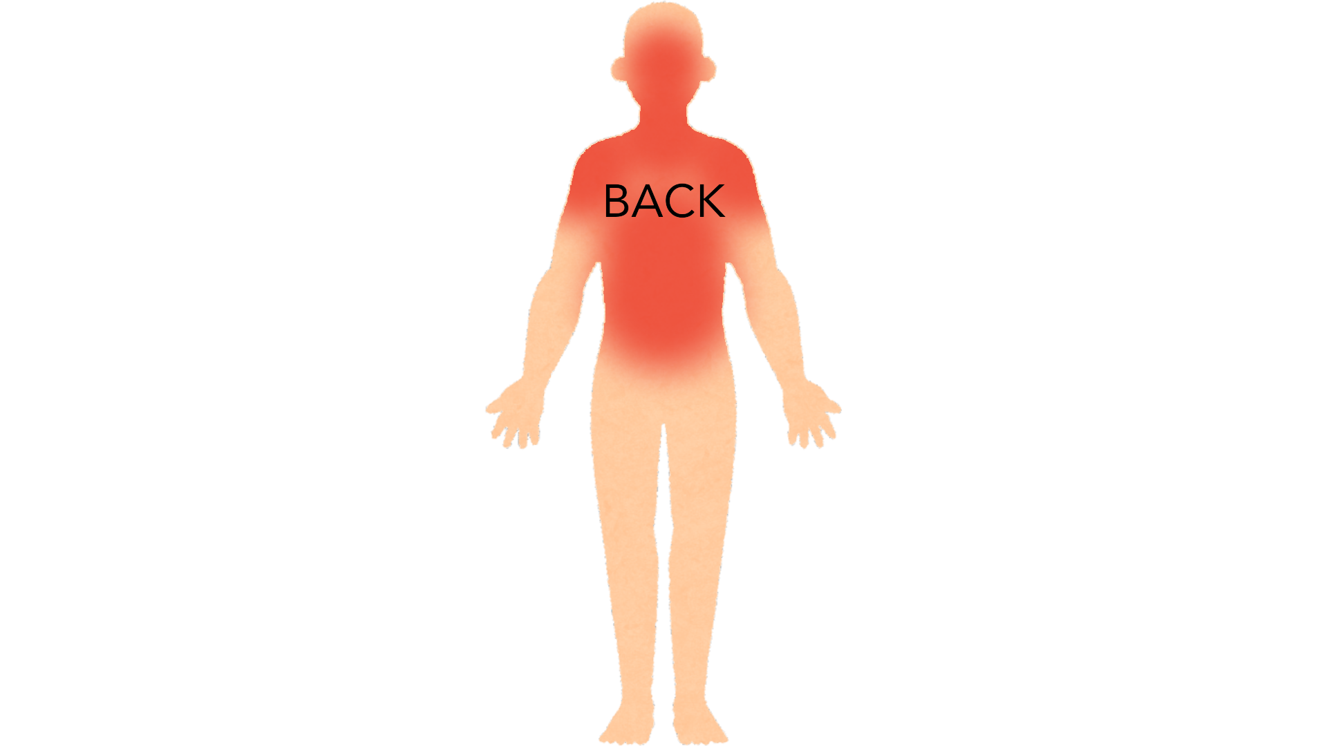 Back view of a whole body with red marks across both shoulders, the upper and middle back, the back of the neck and the head.