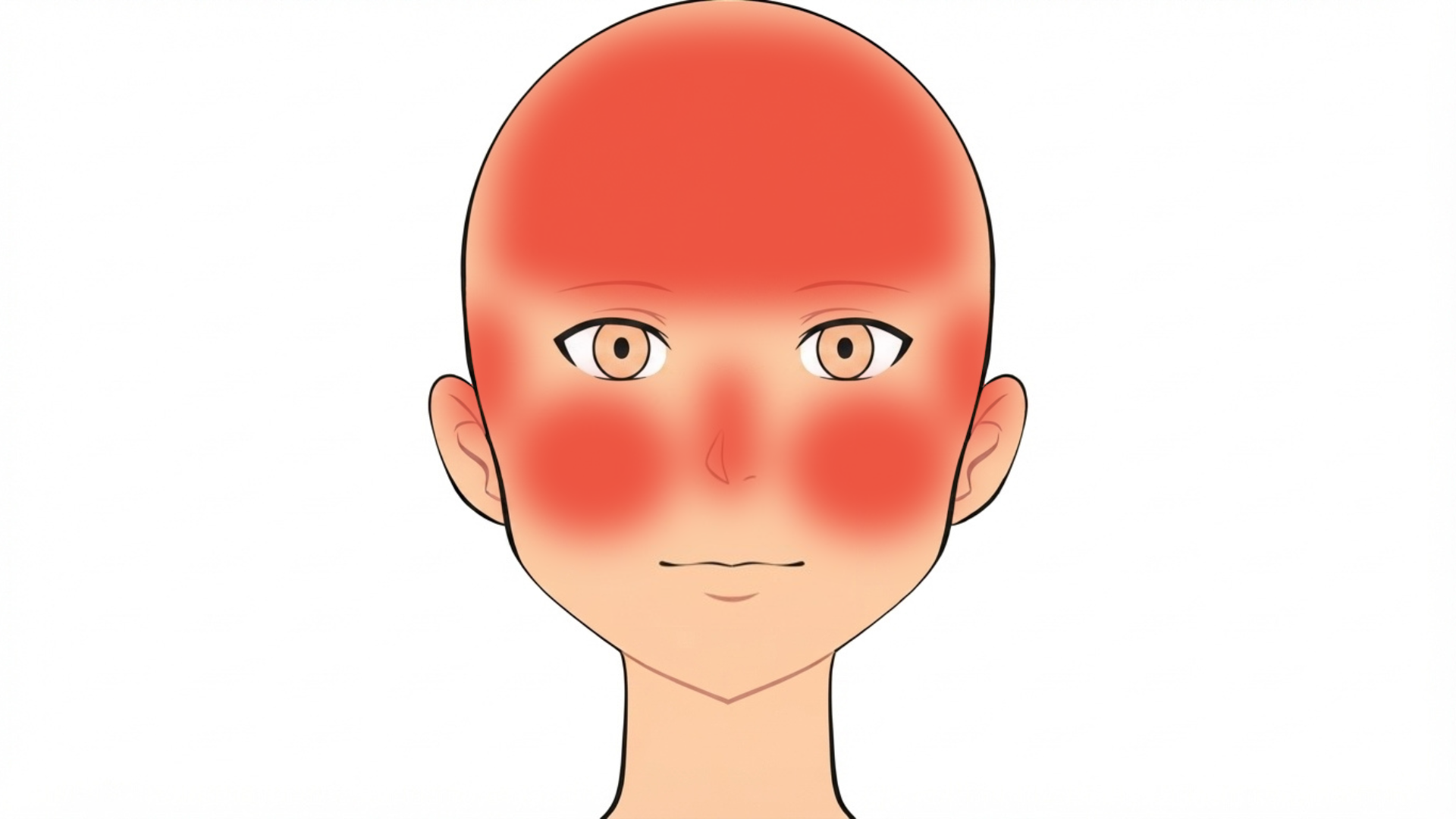 Front view of a head with red marks across the forehead, on both cheeks, at both temples, on the nose and on the top of the scalp.