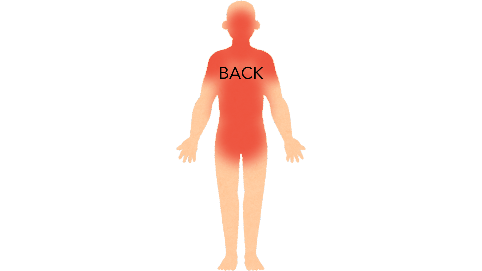 Back view of a whole body with red marks across the upper, middle and lower back, both shoulders, the back of the neck and the head.
