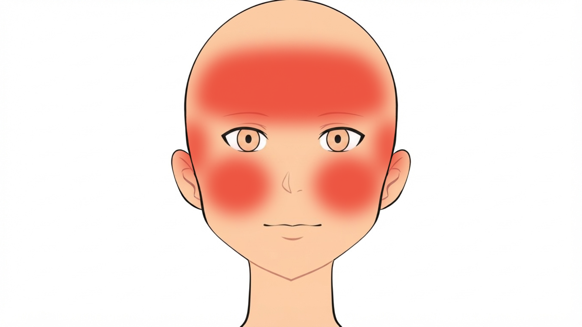 Front view of a head with red marks on both cheeks, both temples and both sides of the forehead.