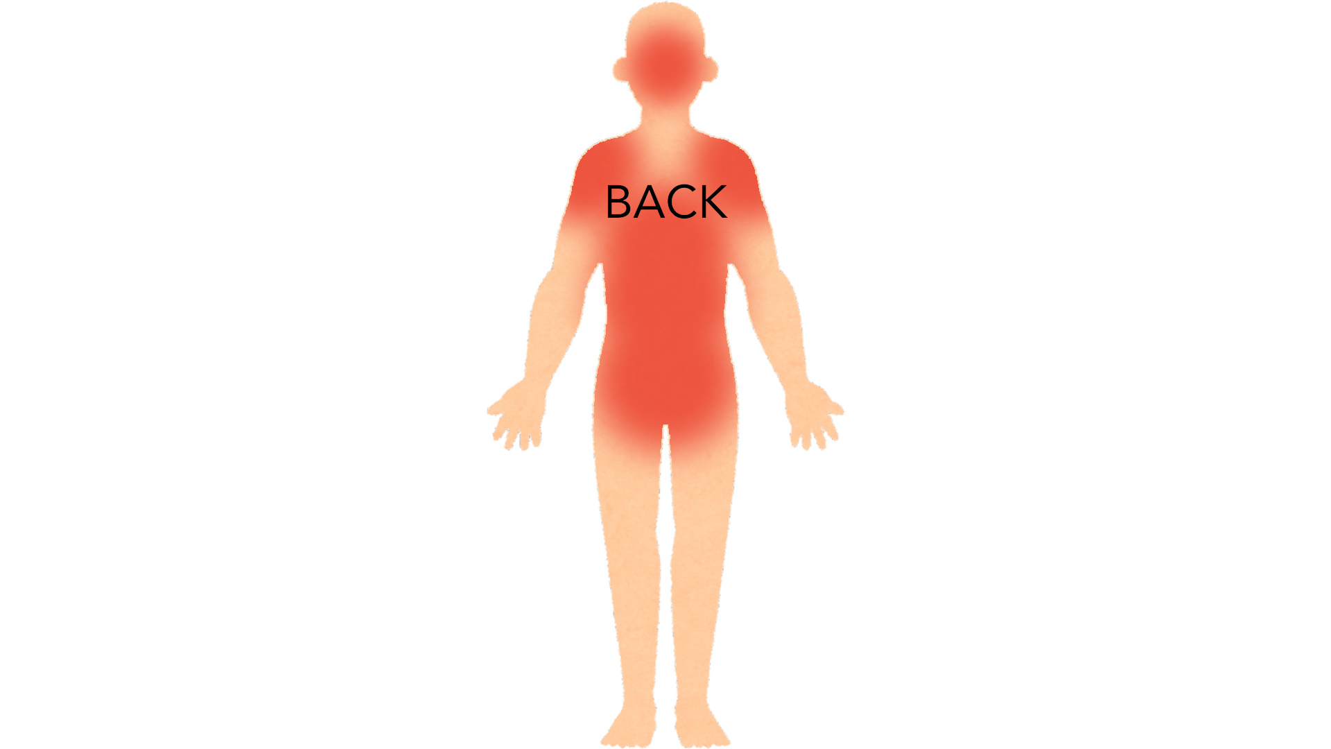 Back view of a whole body with red marks across the upper and middle back, both shoulders, the lower back and the back of the head.