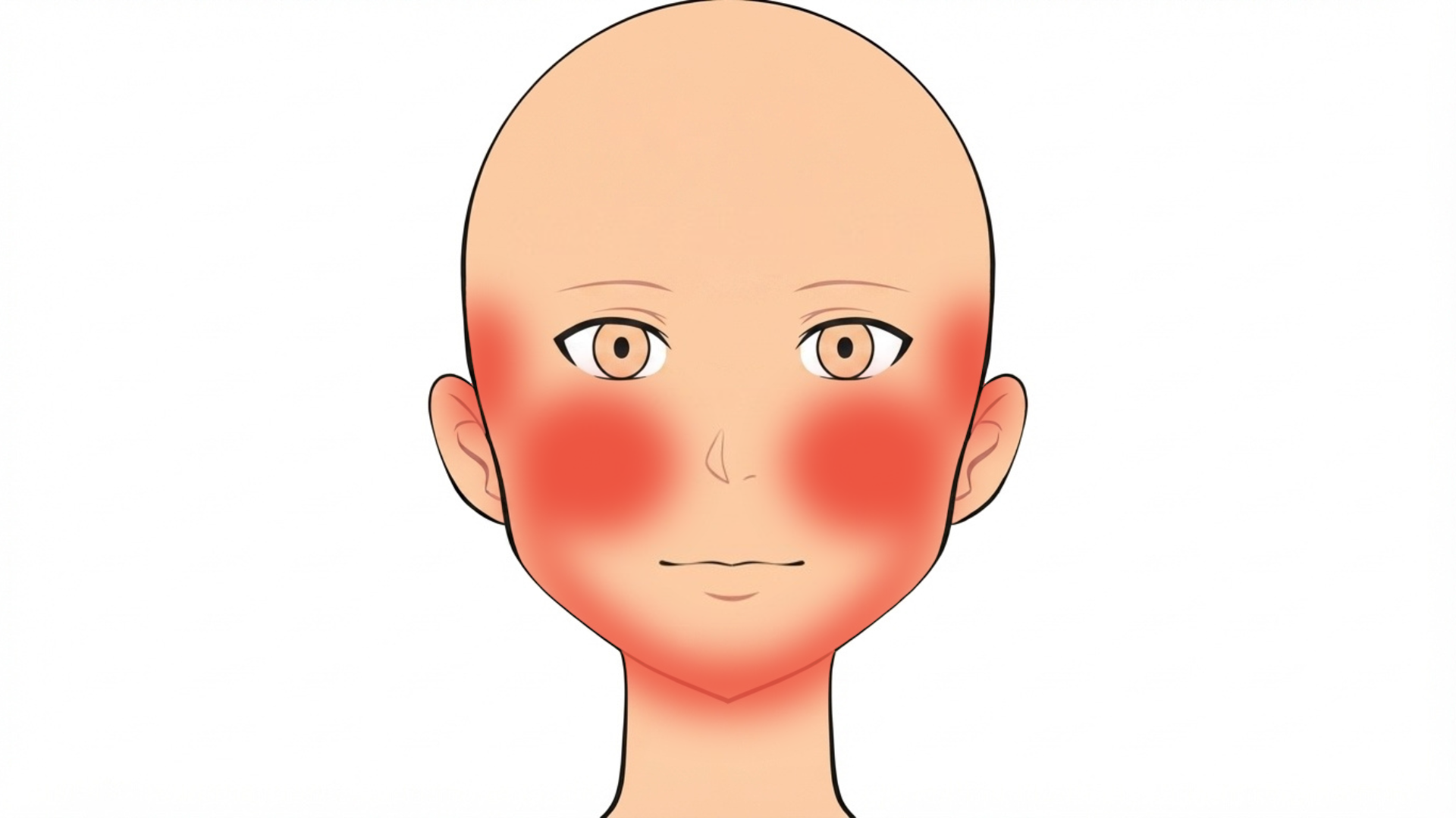 Front view of a head with red marks on both cheeks, both temples and along both sides of the jaw.