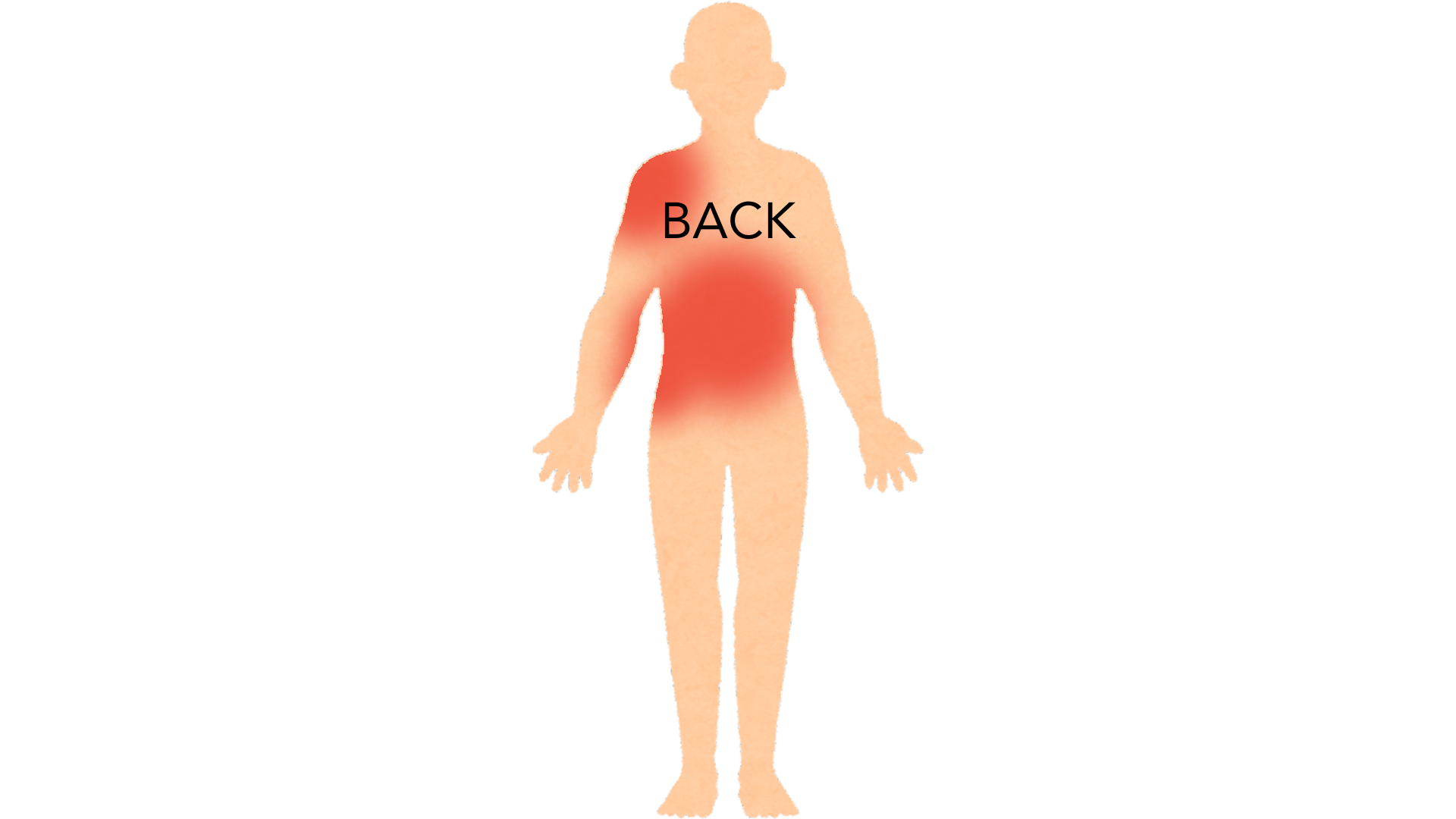 Back view of a whole body with red marks forming a band across one side of the back and waist, stopping at the middle. The other side is clear.