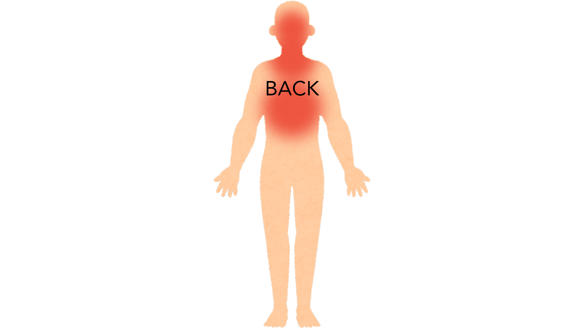 Back view of a whole body with red marks along the hairline at the nape of the neck and across the upper back. The rest of the body is clear.