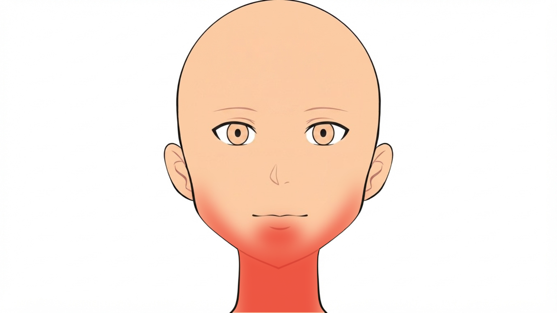 Front view of a head with red marks along the beard area of the jaw and chin and down both sides of the front of the neck.