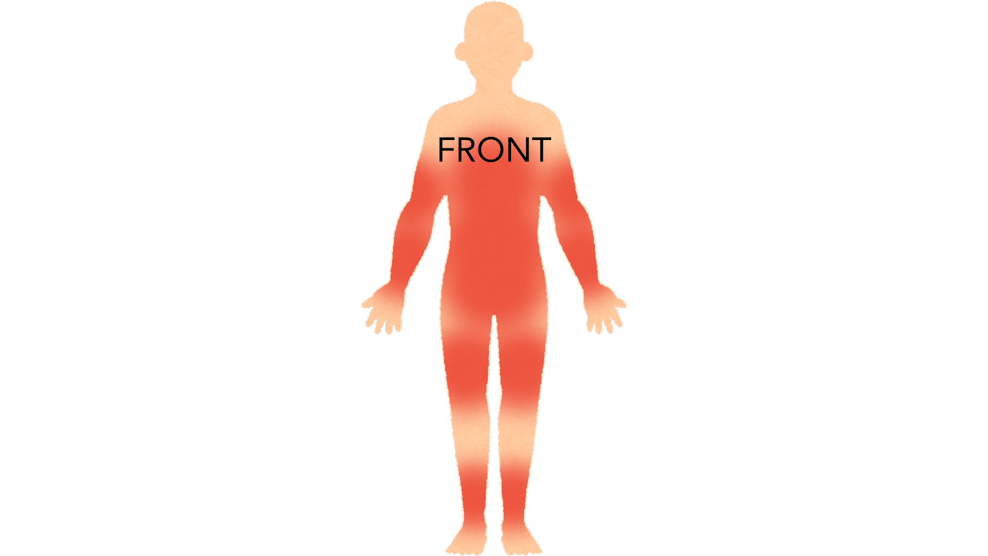 Front view of a whole body with red marks scattered over the chest, abdomen, waist, both arms and both legs.