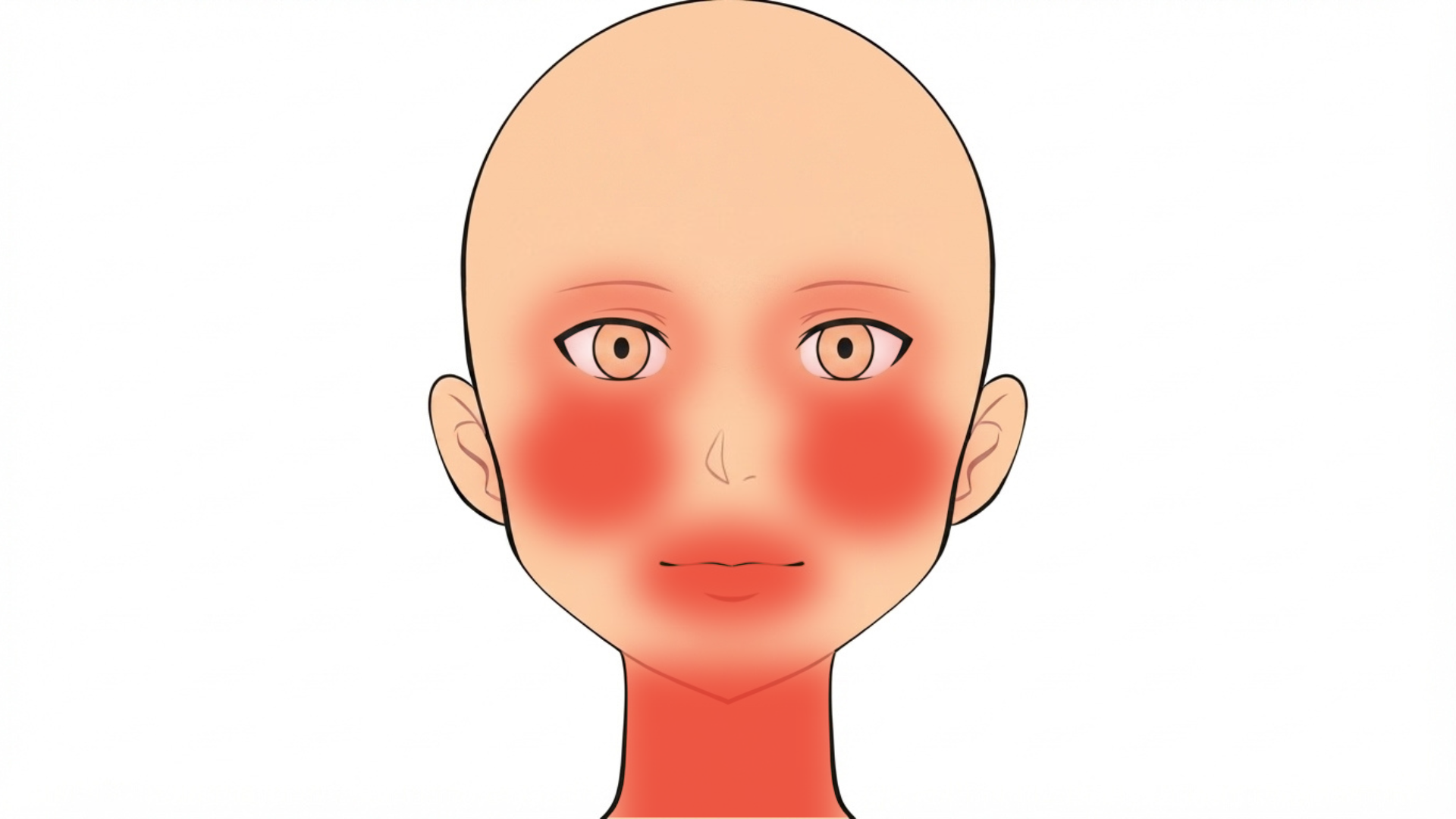 Front view of a head with red marks around both eyes, on the upper and lower lip, on both cheeks and on the neck.