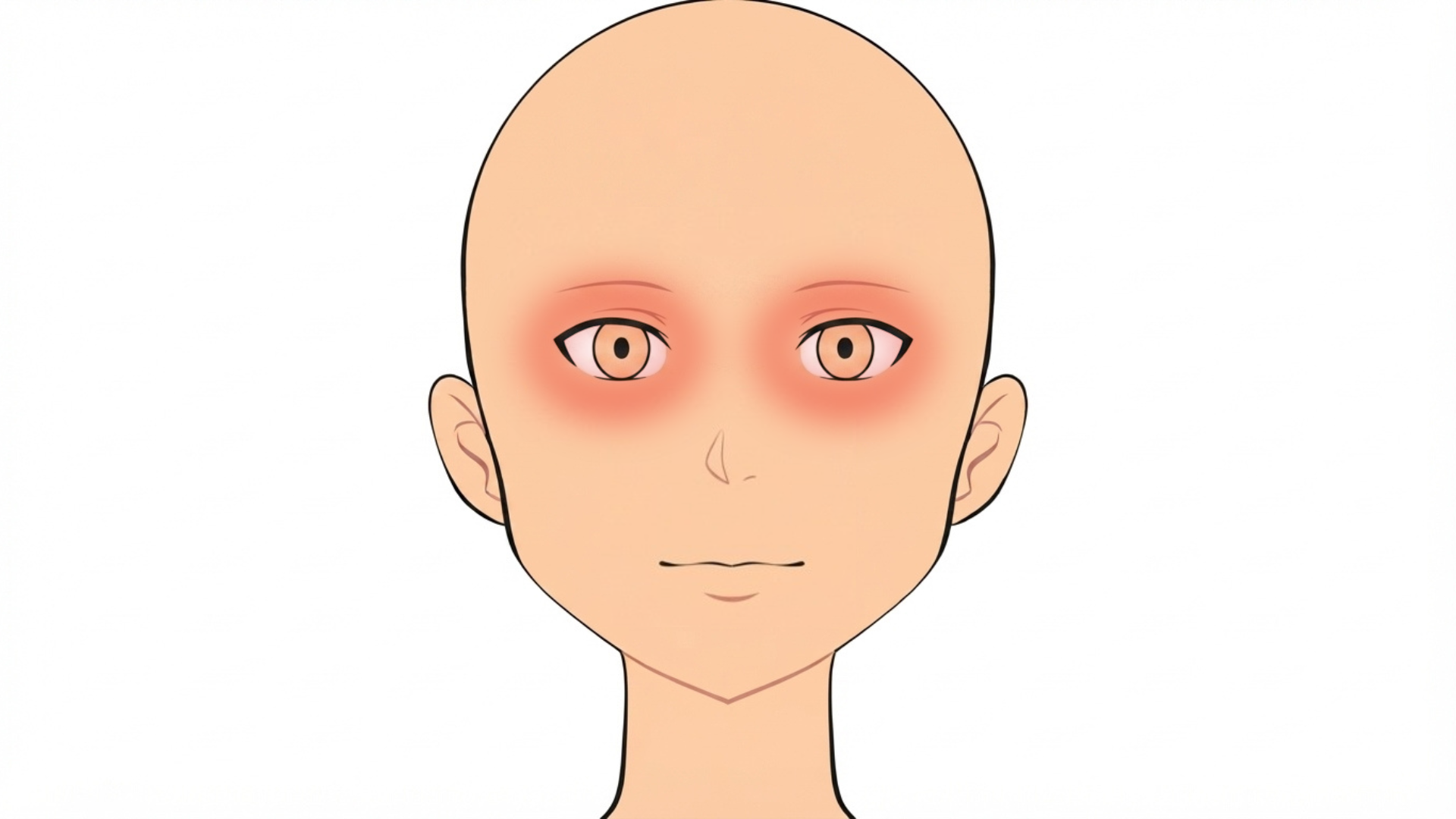 Front view of a head with red marks under both eyes. The rest of the face is clear.