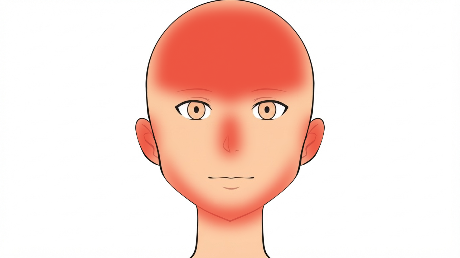 Front view of a head with red marks across the scalp, on both eyebrows and between them, in the creases beside the nose, on both ears and along the beard area of the jaw.