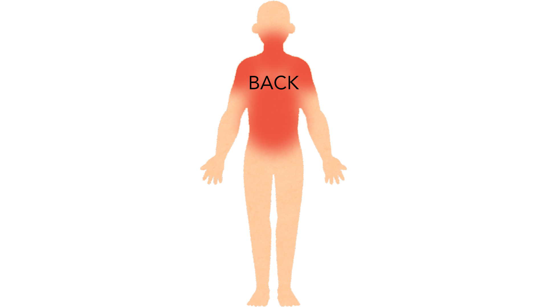 Back view of a whole body with red marks across the upper back, both shoulders and the back of the neck. The rest of the body is clear.