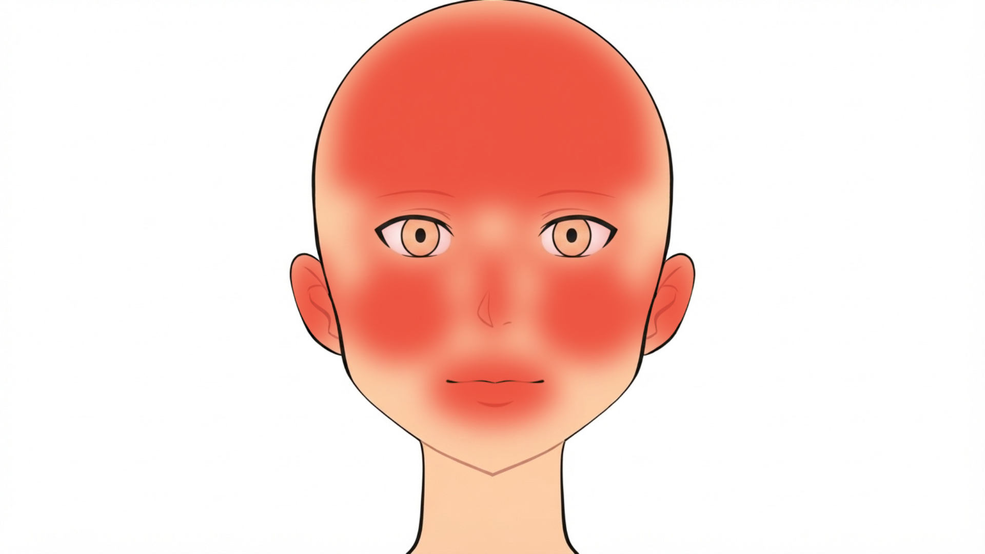 Front view of a head with red marks on the nose, across the forehead, on both cheeks, on both ears, around both eyes, on the upper lip and on the top of the scalp.