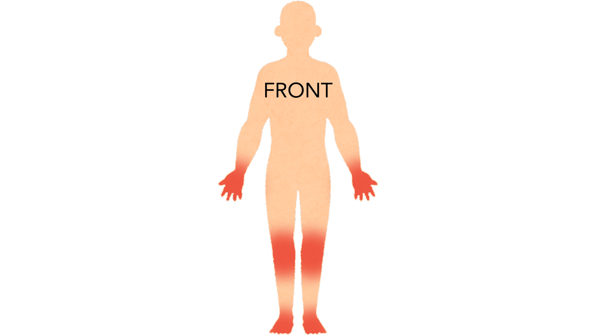 Front view of a whole body with red marks on both hands and fingers, on both knees and on both feet.