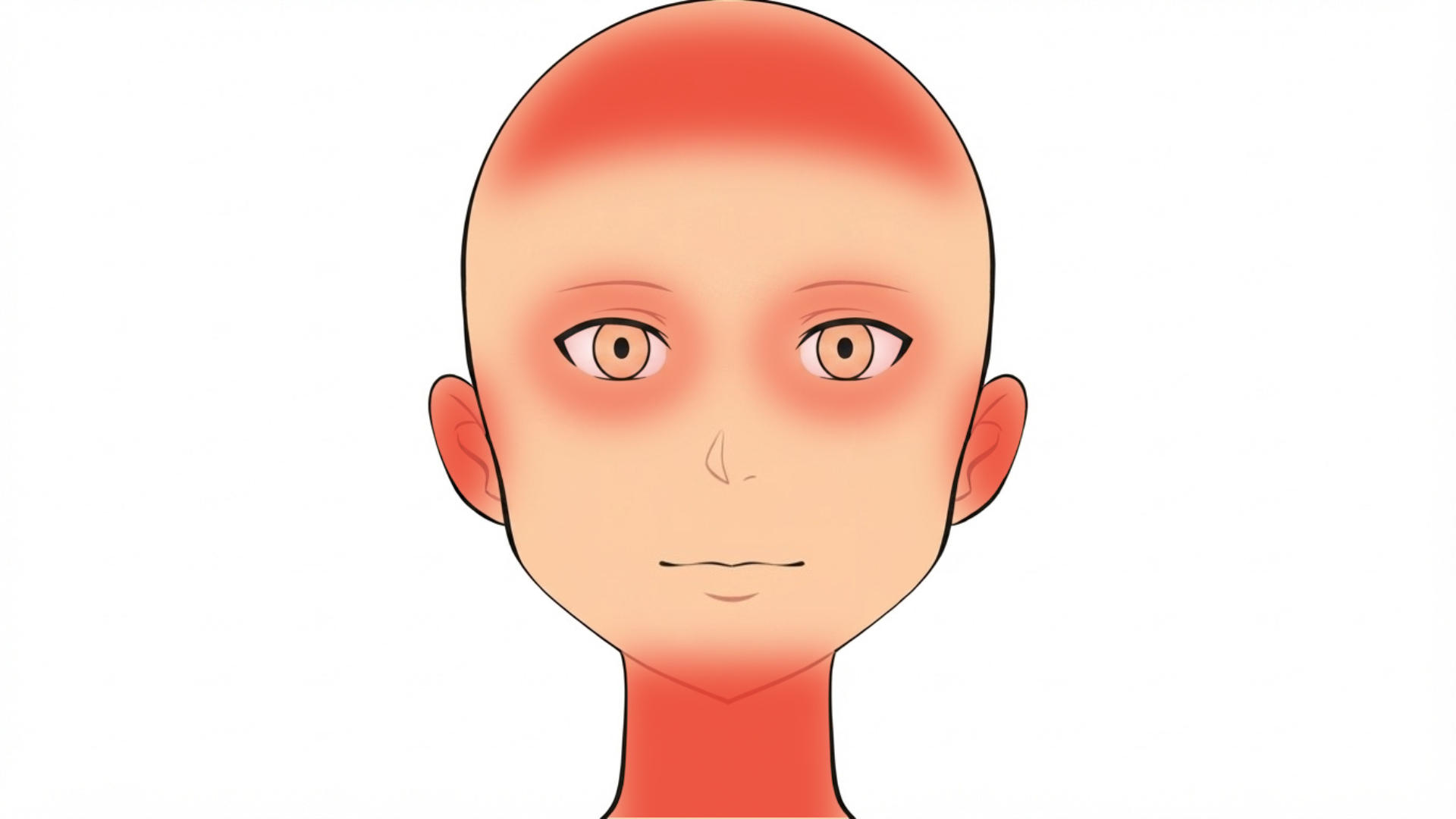 Front view of a head with red marks around both eyes, on both ears, on the neck and on the scalp.
