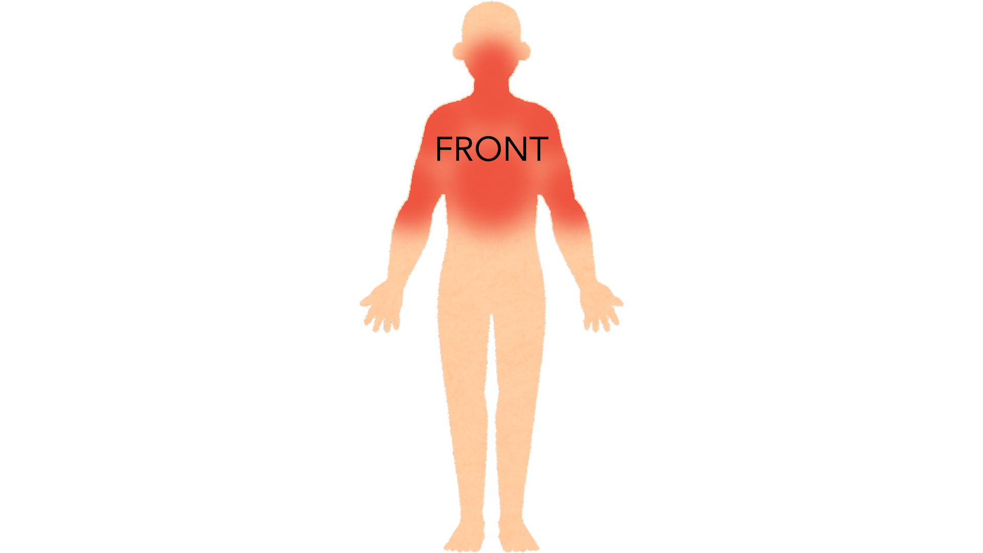 Front view of a whole body with red marks across the upper chest, the neck, both shoulders, both upper arms and the face.