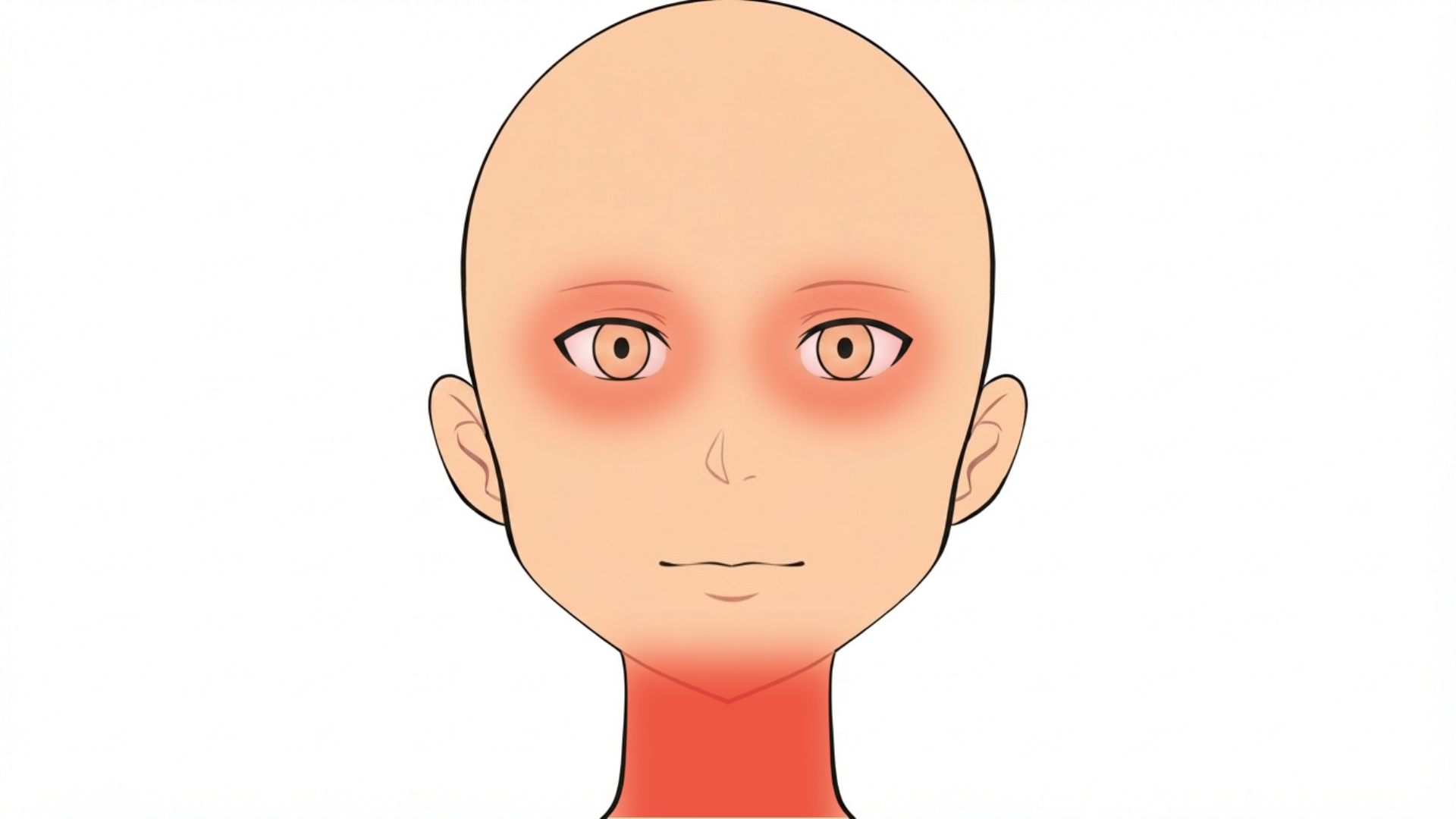 Front view of a head with red marks on both eyelids and down both sides of the neck.