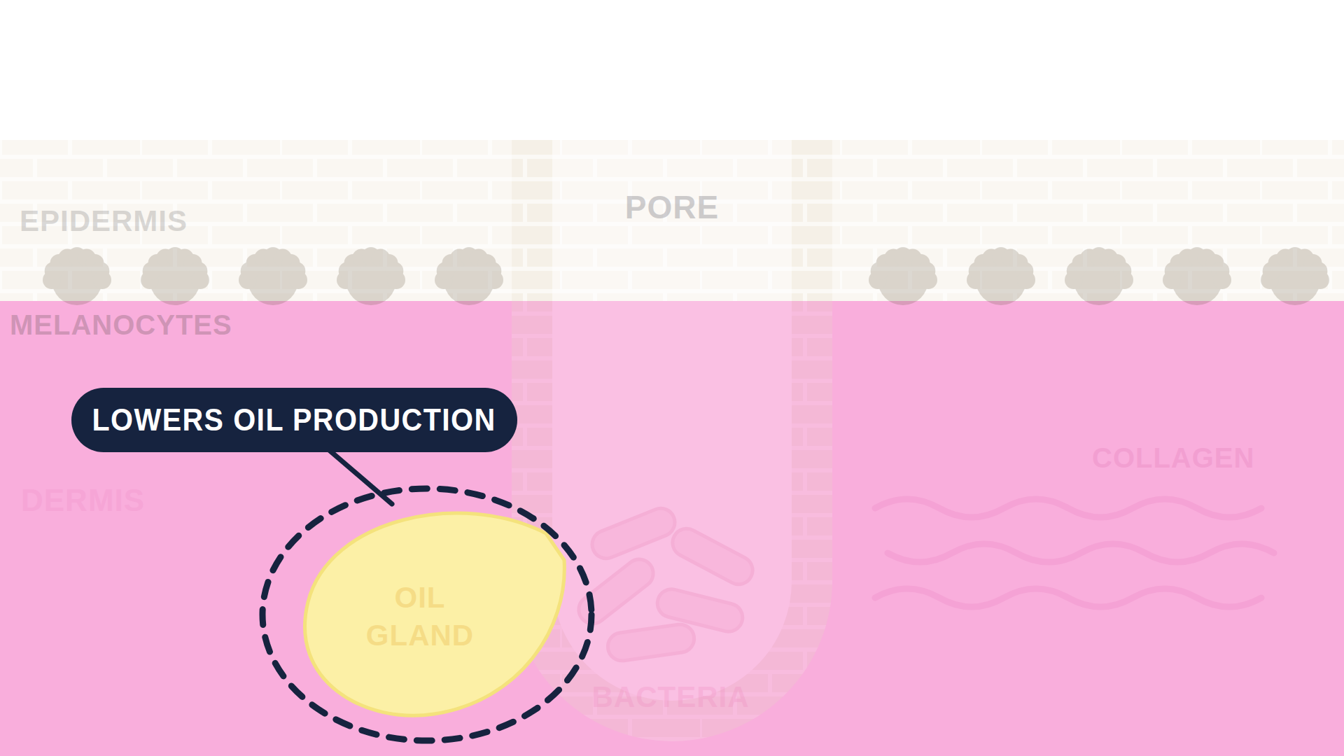 Diagram: how Spironolactone works in the skin