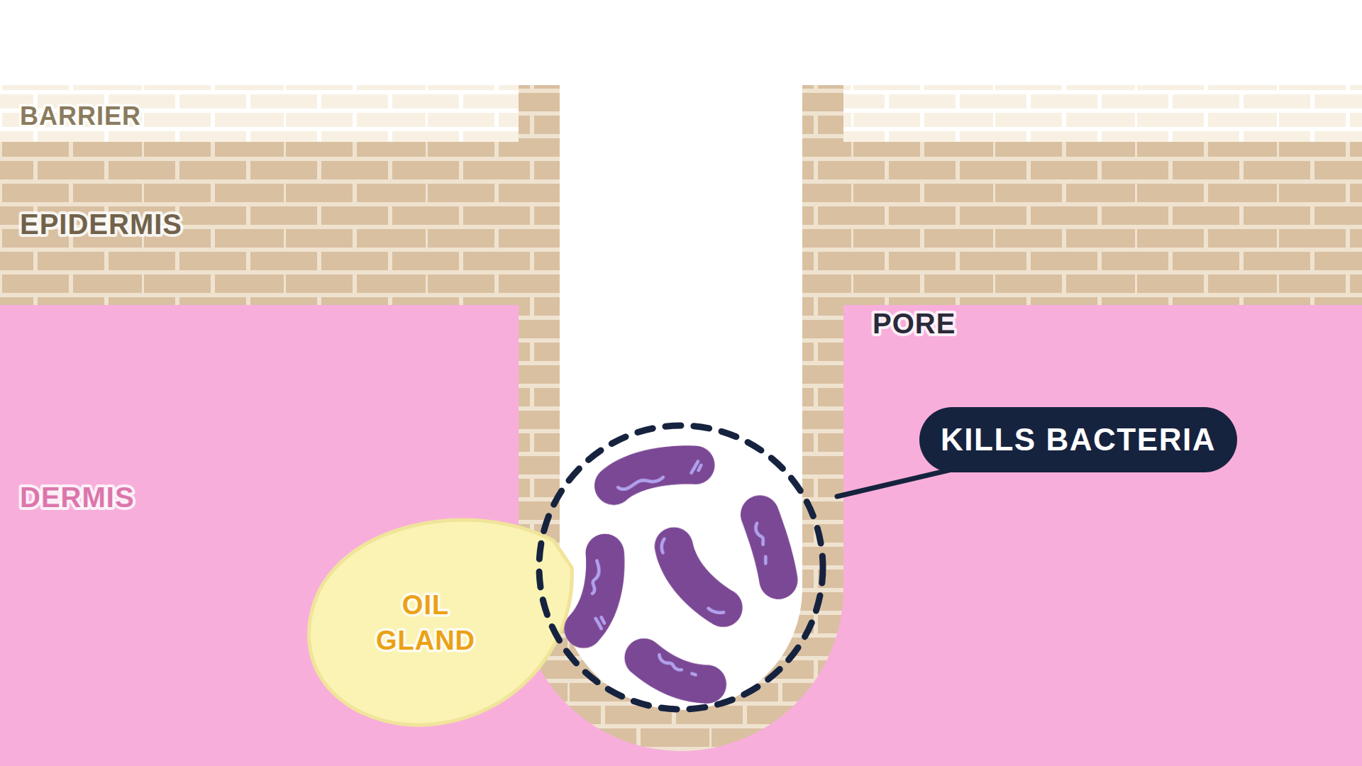 Diagram: how Metronidazole (MetroGel) works in the skin
