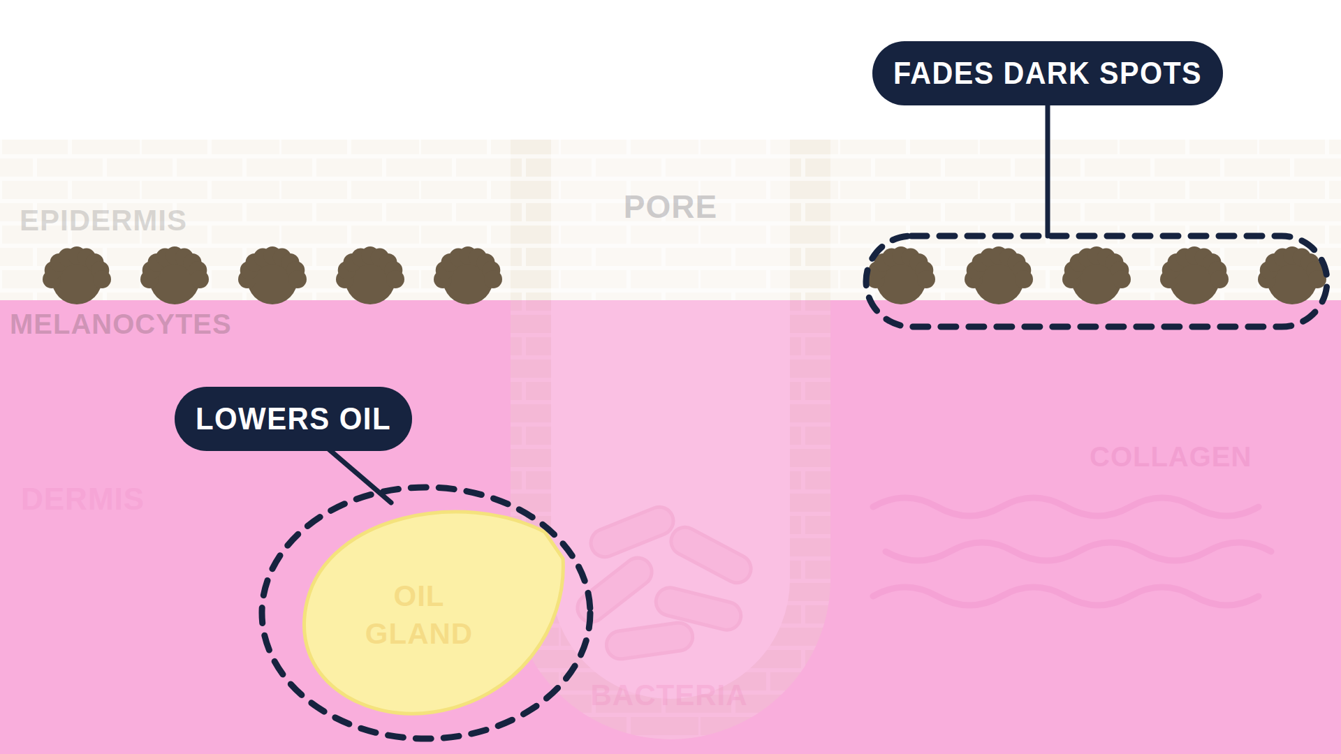 Labeled cutaway diagram of a single skin pore, headed Niacinamide. The epidermis is a brick-textured band across the top and the dermis is pink below it, with a yellow oil gland at the base of the pore and a small cluster of bacteria inside it. Two callout lines point in: decreases inflammation is drawn in dark navy as the main effect, and decreases oil production is drawn in gray as a lesser one. Nothing points at the dead cells blocking the pore.