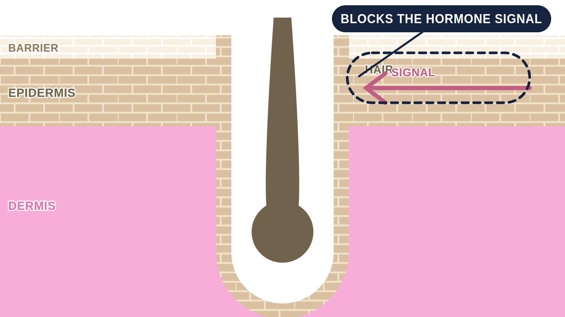 Diagram: how Finasteride works in the skin