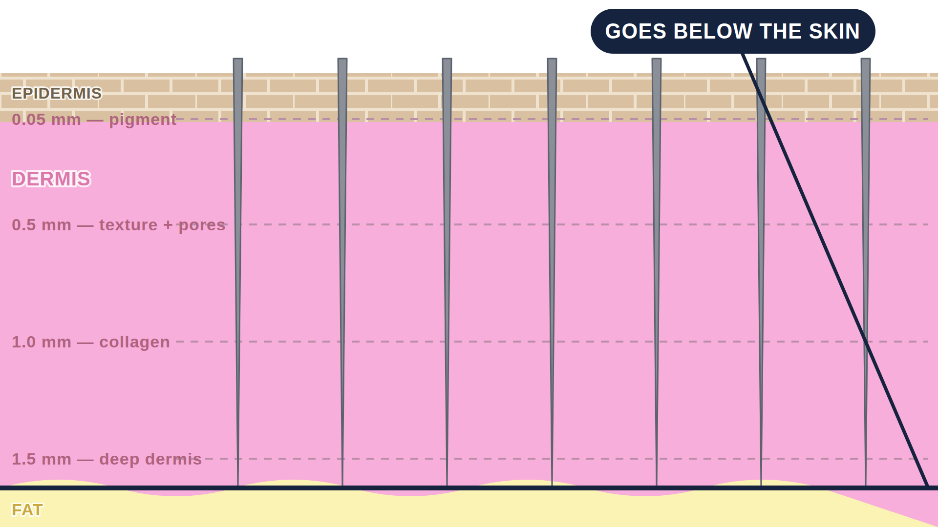 Diagram: how Hair Transplant works in the skin