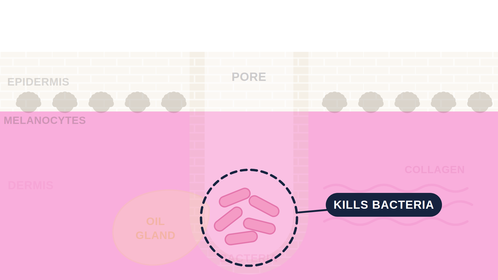 Labeled cutaway diagram of a single skin pore. The epidermis is drawn as a brick-textured layer across the top and the dermis in pink below it, with a yellow oil gland at the base of the pore. Three callout lines point into the pore: decreases dead cells in pore near the opening, kills bacteria at the cluster of bacteria deep in the shaft, and decreases inflammation in the surrounding dermis.