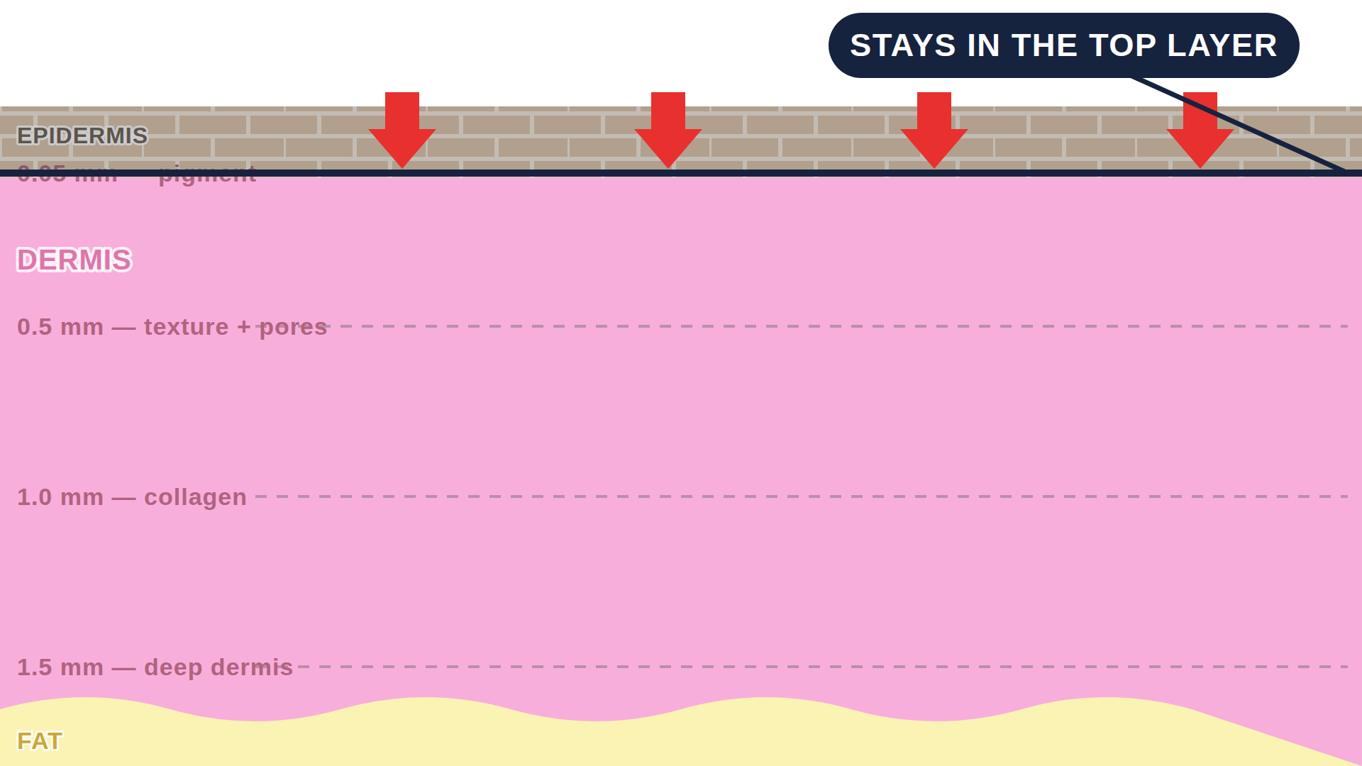 Diagram: how Microdermabrasion works in the skin