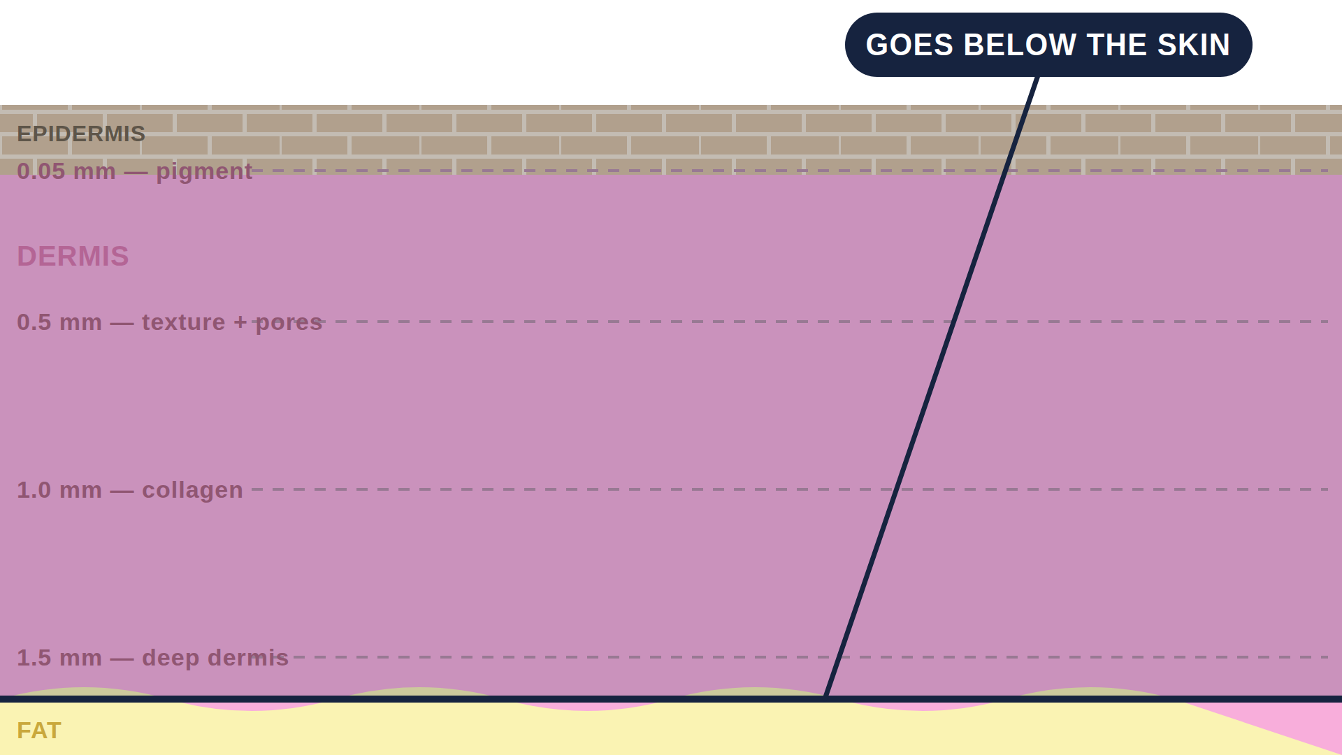 Diagram: how RF Microneedling works in the skin