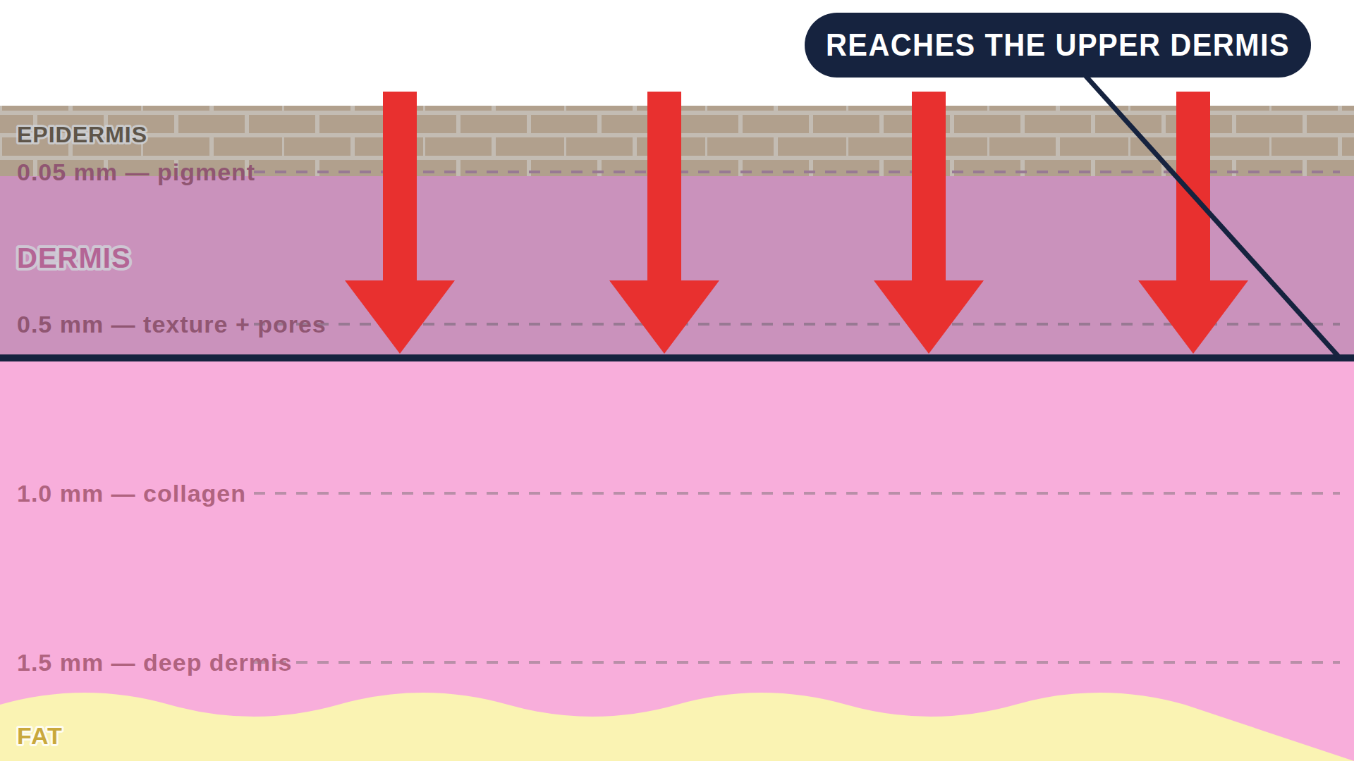 Diagram: how Chemical Peel works in the skin
